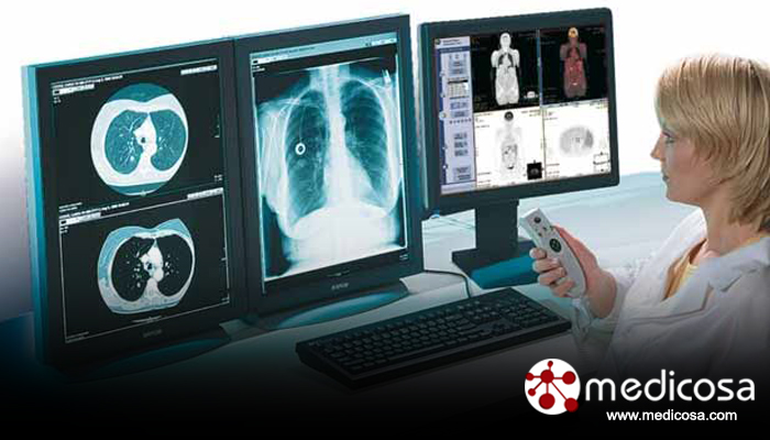 pacs radiology